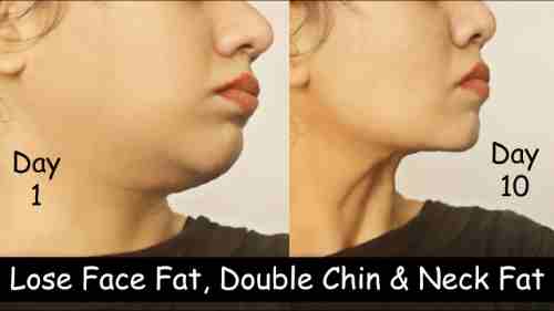 How To Lose Neck Fat