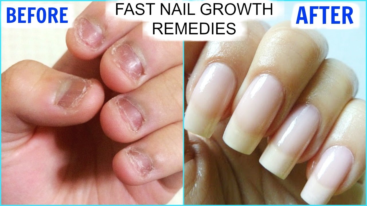 How Grow Nails Fast And Strong